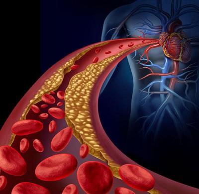 TRATAMIENTOS EN LA ENFERMEDAD RENAL CRÓNICA