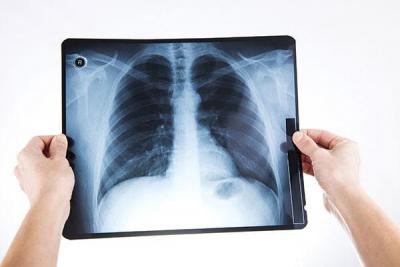 TRATAMIENTOS EN LA ENFERMEDAD RENAL CRÓNICA